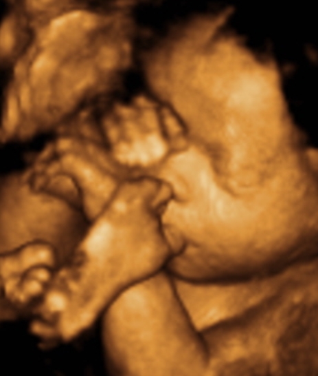 Ultrasound Photo Gallery, 3D Photos by Week. Statesville 