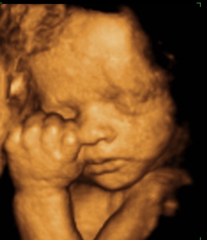 Ultrasound Photo Gallery, 3D Photos by Week. Statesville NC Sonogram